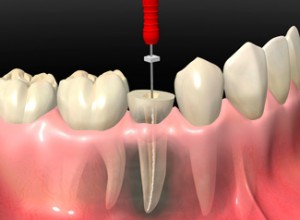 ENDODONCIA-mod